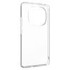 Fixed Story | Back Cover | Xiaomi | Redmi Note 14 Pro+ 5G | TPU | Clear